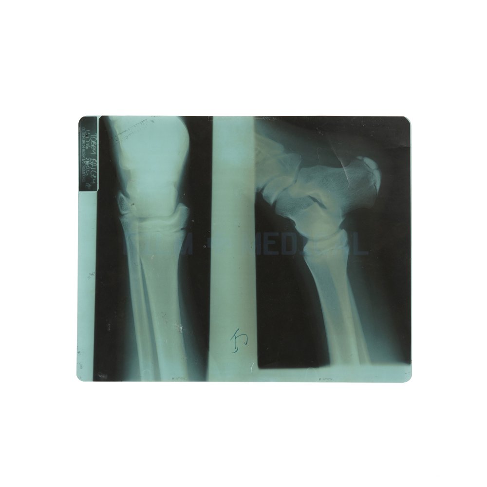 XRay Leg FILM MEDICAL