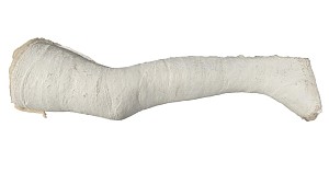 White Full Leg Cast