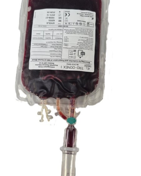 Blood Bag With Giving Set