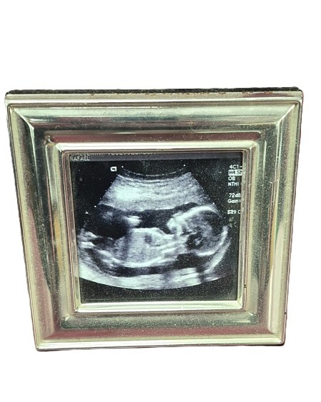 Framed Image Of A Fetus