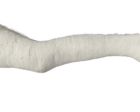 White Full Leg Cast