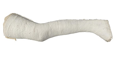 White Full Leg Cast