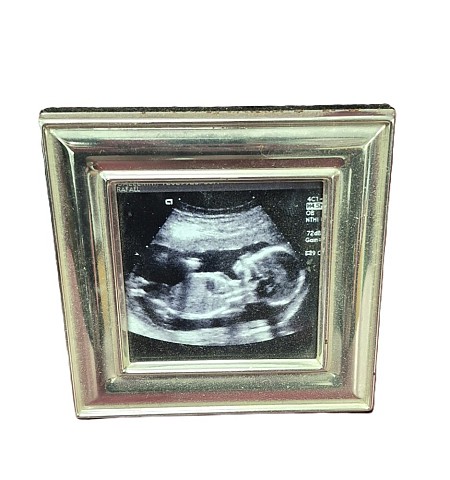Framed Image Of A Fetus