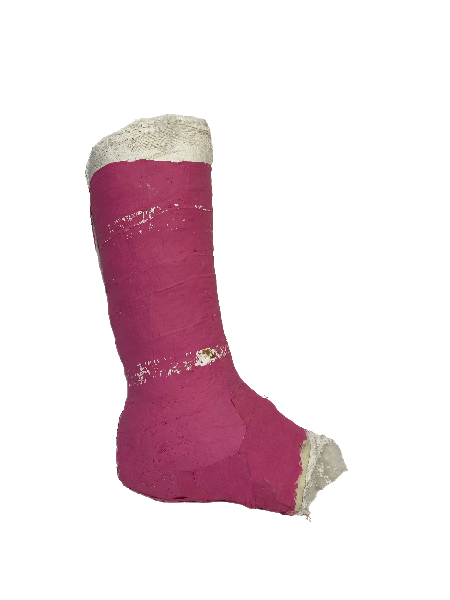 Plaster Half Leg Cast (Pink)