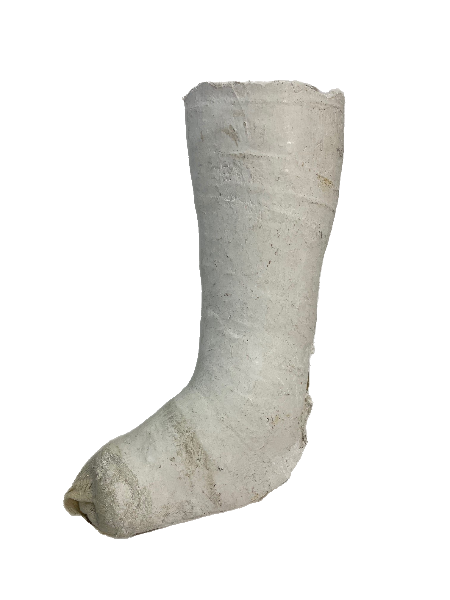 Plaster Half Leg Cast