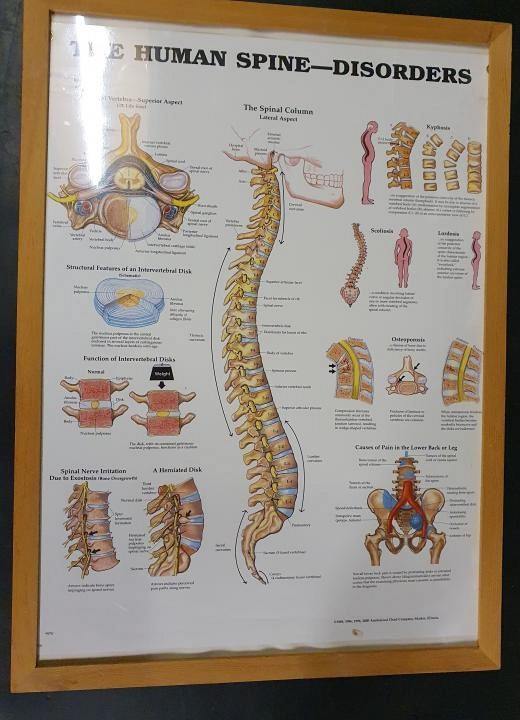 Anatomical Framed Print Human Spine