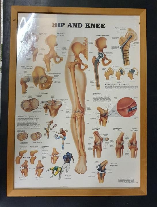 Anatomical Framed Print Hip & Knee