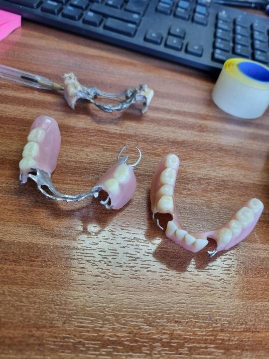 Pair of dentures 