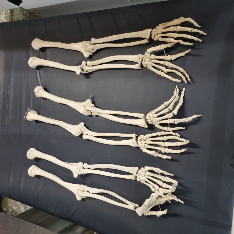 Skeleton arm