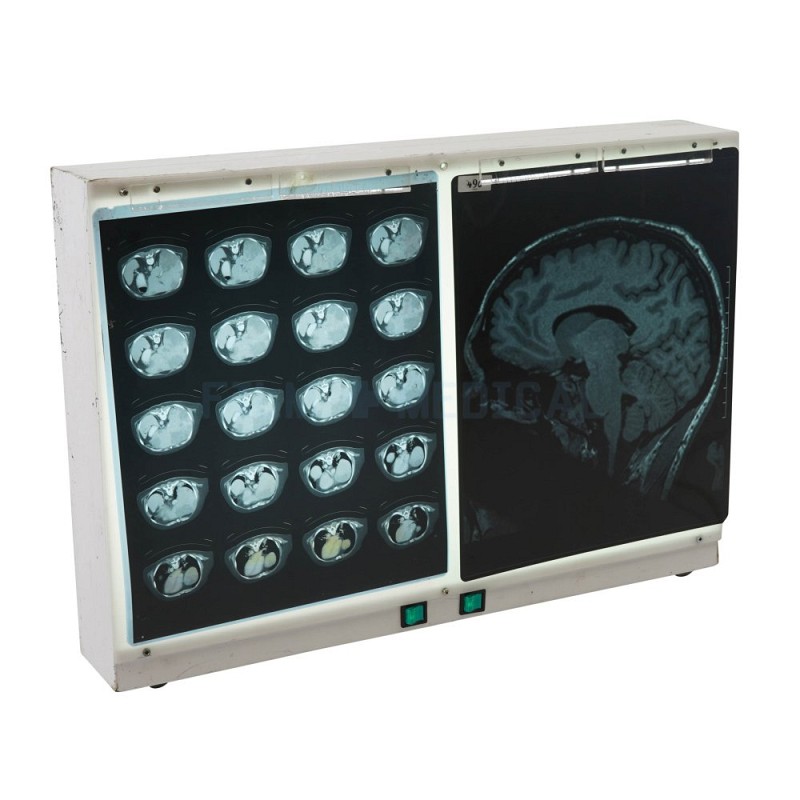 Double Light Box (X-Rays Priced Separately)