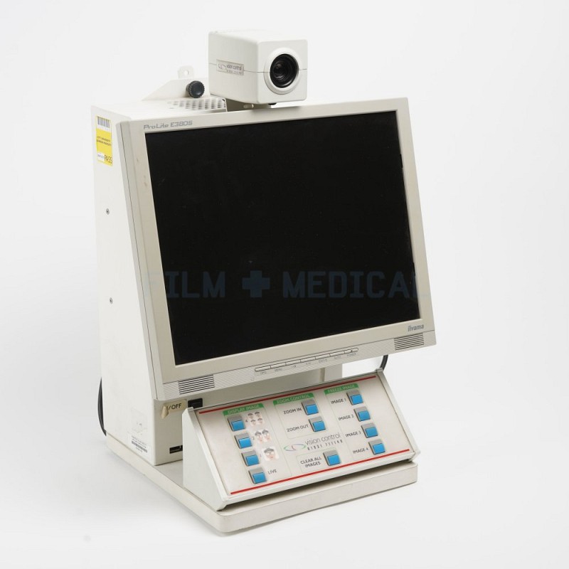 Optician Monitor 