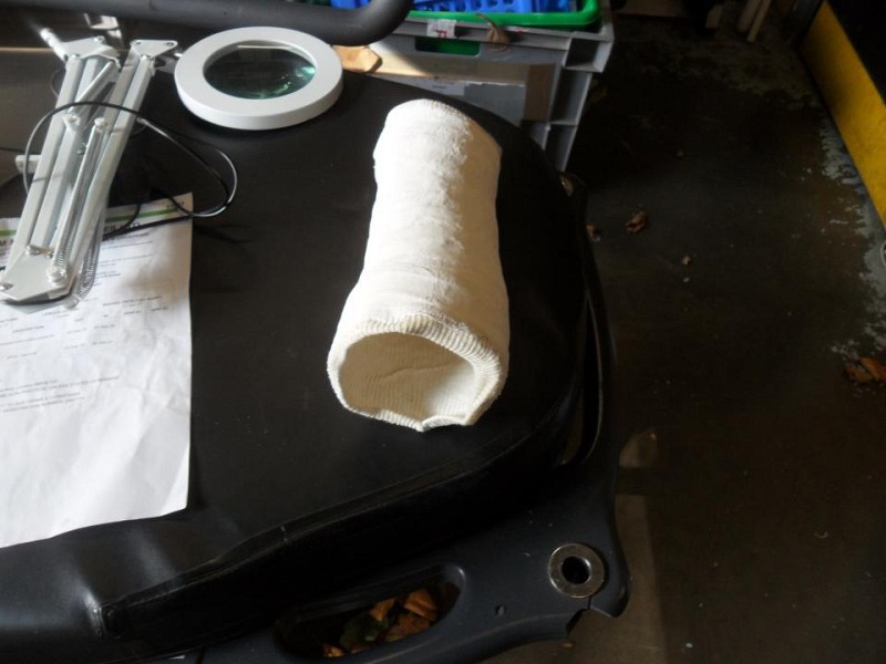 arm cast