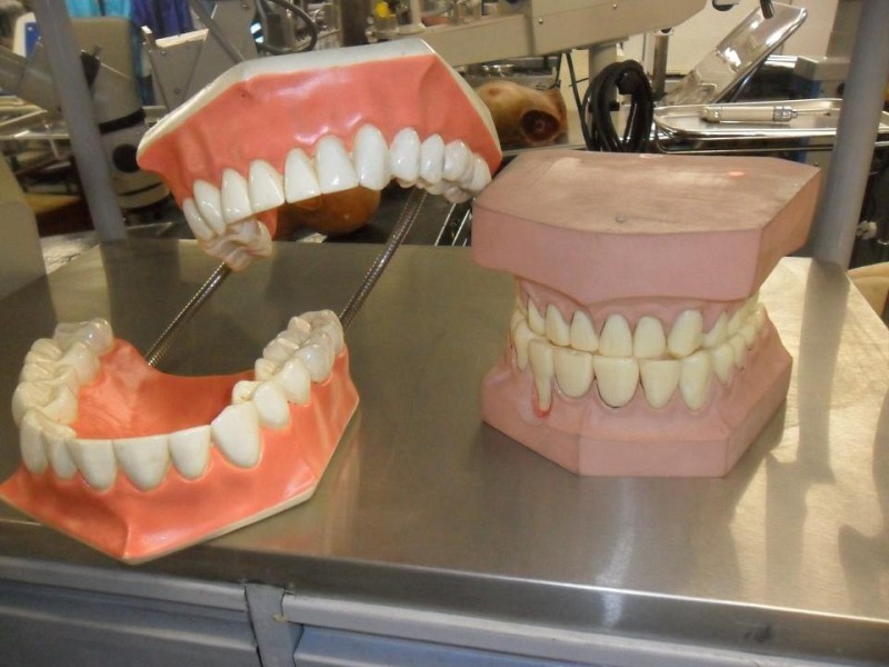 Dental model