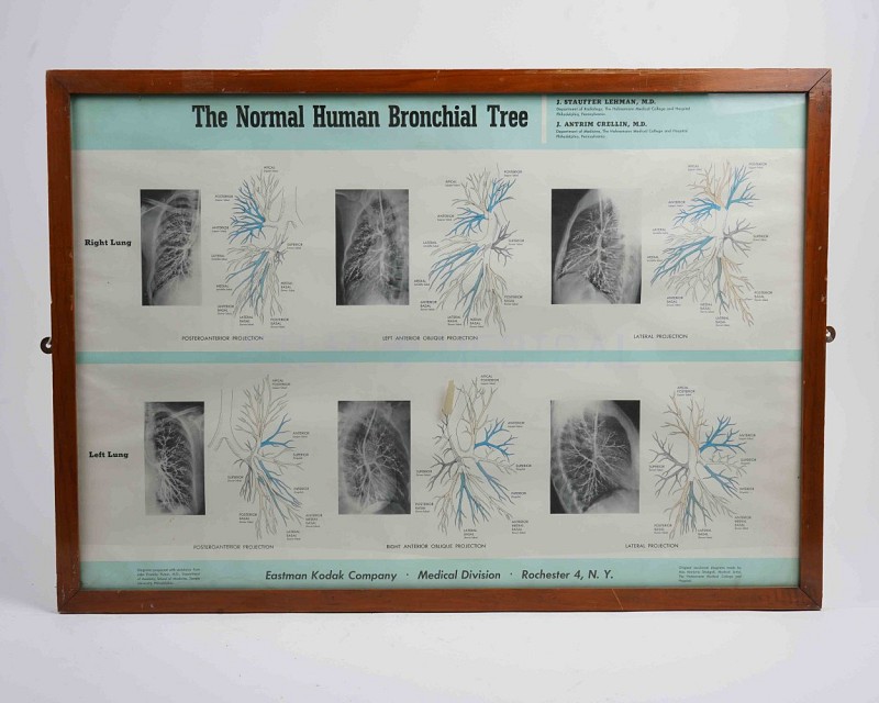 Framed Picture Bronchial Tree