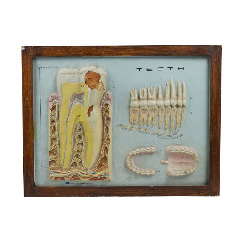 Teeth Framed 3D Picture