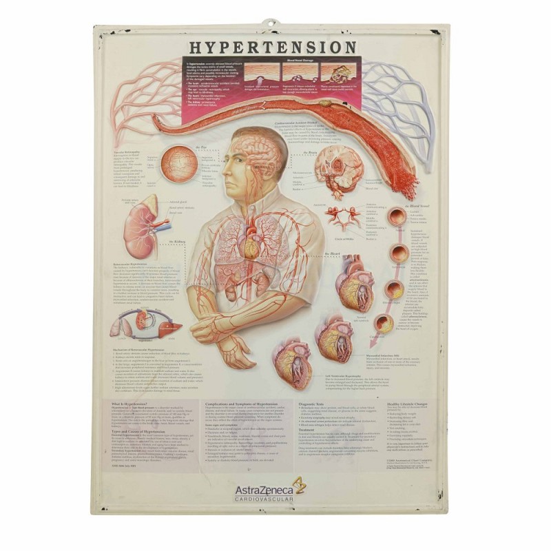 Hypertension Poster 3D