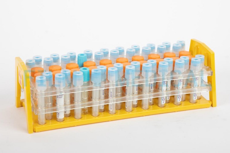 Sample Rack with Vacutainers  