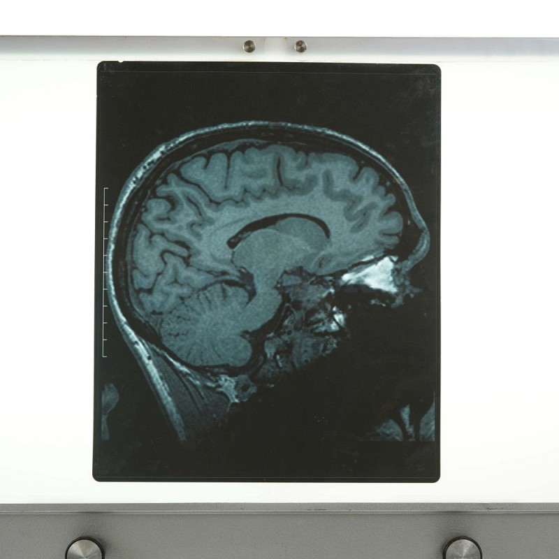 X-Ray Brain