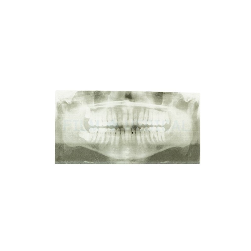 X-Ray Dental