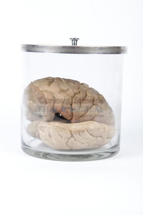 Specimen Brain In Jar