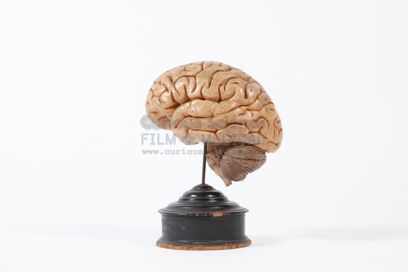 Period Brain Model on Stand