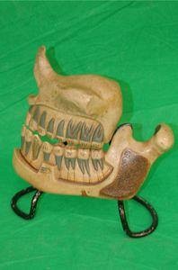 Dental Teaching Model of the Jaw