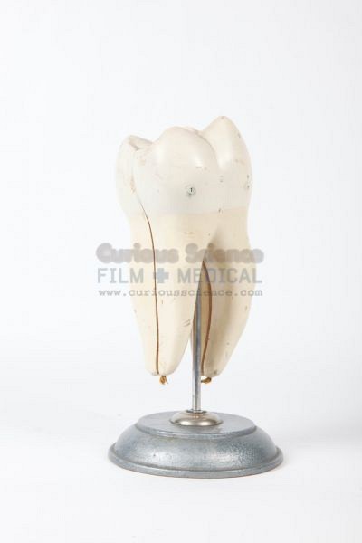 Model of tooth