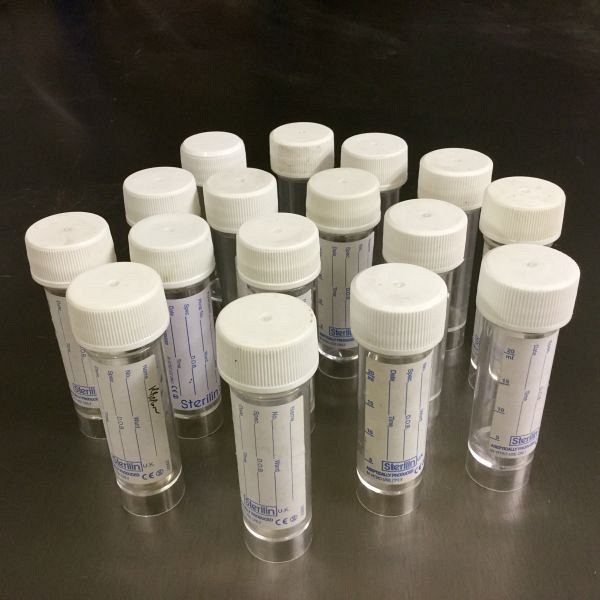 Urine sample containers